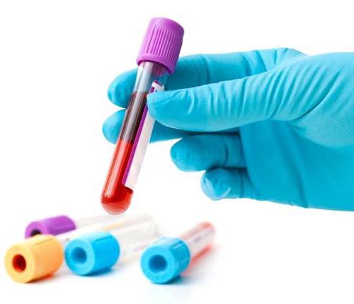Blodtest för HIV-avkodning