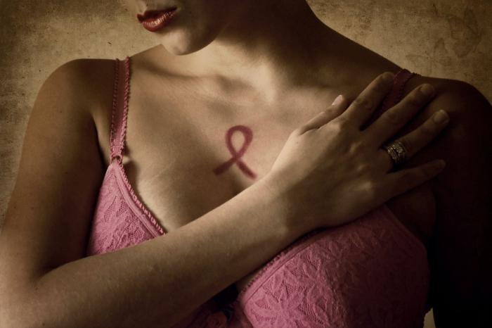 behandling av bröstcancer i Israel